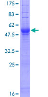 IGSF1 Protein - 12.5% SDS-PAGE of human IGSF1 stained with Coomassie Blue