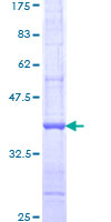 IGSF1 Protein - 12.5% SDS-PAGE Stained with Coomassie Blue.