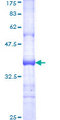 IGSF10 Protein - 12.5% SDS-PAGE Stained with Coomassie Blue.