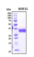 IGSF11 / VSIG3 Protein - SDS-PAGE under reducing conditions and visualized by Coomassie blue staining