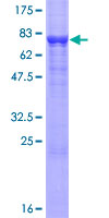 IGSF21 Protein - 12.5% SDS-PAGE of human IGSF21 stained with Coomassie Blue