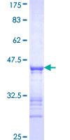 IGSF21 Protein - 12.5% SDS-PAGE Stained with Coomassie Blue.