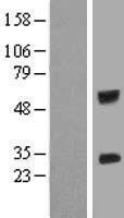 IGSF6 Protein - Western validation with an anti-DDK antibody * L: Control HEK293 lysate R: Over-expression lysate