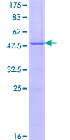 IGSF6 Protein - 12.5% SDS-PAGE of human IGSF6 stained with Coomassie Blue