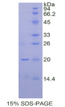 IHH Protein - Recombinant Hedgehog Homolog, Indian By SDS-PAGE