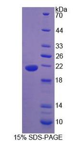 IHH Protein - Recombinant Hedgehog Homolog, Indian (IHH) by SDS-PAGE