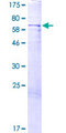 IIP45 / MIIP Protein - 12.5% SDS-PAGE of human RP5-1077B9.4 stained with Coomassie Blue