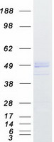 IIP45 / MIIP Protein - Purified recombinant protein MIIP was analyzed by SDS-PAGE gel and Coomassie Blue Staining