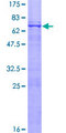 IK3-1 / CABLES1 Protein - 12.5% SDS-PAGE of human CABLES1 stained with Coomassie Blue
