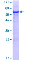 IKBIP Protein - 12.5% SDS-PAGE of human IKIP stained with Coomassie Blue
