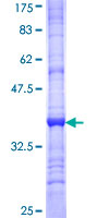 IKBKAP / IKAP Protein - 12.5% SDS-PAGE Stained with Coomassie Blue.