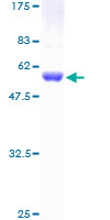 IKBKB / IKK2 / IKK Beta Protein - 12.5% SDS-PAGE of human IKBKB stained with Coomassie Blue