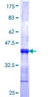 IKBKB / IKK2 / IKK Beta Protein - 12.5% SDS-PAGE Stained with Coomassie Blue.