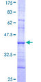 IKBKE / IKKI / IKKE Protein - 12.5% SDS-PAGE Stained with Coomassie Blue.