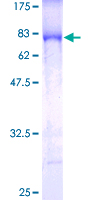 IKBKG / NEMO / IKK Gamma Protein - 12.5% SDS-PAGE of human IKBKG stained with Coomassie Blue