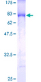 IKBKG / NEMO / IKK Gamma Protein - 12.5% SDS-PAGE of human IKBKG stained with Coomassie Blue