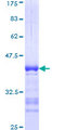 IKBKG / NEMO / IKK Gamma Protein - 12.5% SDS-PAGE Stained with Coomassie Blue.