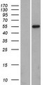IKZF1 / IKAROS Protein - Western validation with an anti-DDK antibody * L: Control HEK293 lysate R: Over-expression lysate