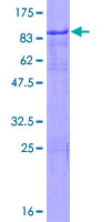 IKZF2 / HELIOS Protein - 12.5% SDS-PAGE of human ZNFN1A2 stained with Coomassie Blue