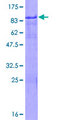 IKZF2 / HELIOS Protein - 12.5% SDS-PAGE of human ZNFN1A2 stained with Coomassie Blue