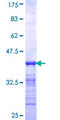 IKZF2 / HELIOS Protein - 12.5% SDS-PAGE Stained with Coomassie Blue.