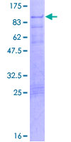 IKZF4 / EOS Protein - 12.5% SDS-PAGE of human IKZF4 stained with Coomassie Blue