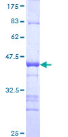 IKZF4 / EOS Protein - 12.5% SDS-PAGE Stained with Coomassie Blue.