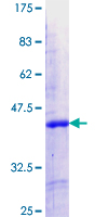 IKZF5 Protein - 12.5% SDS-PAGE Stained with Coomassie Blue.