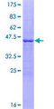 IL-10 Protein - 12.5% SDS-PAGE of human IL10 stained with Coomassie Blue