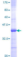 IL-10 Protein - 12.5% SDS-PAGE Stained with Coomassie Blue.