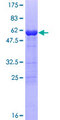 IL-1B / IL-1 Beta Protein - 12.5% SDS-PAGE of human IL1B stained with Coomassie Blue