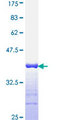 IL-1B / IL-1 Beta Protein - 12.5% SDS-PAGE Stained with Coomassie Blue.