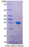 IL-1B / IL-1 Beta Protein