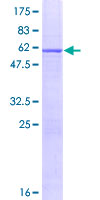 IL-33 Protein - 12.5% SDS-PAGE of human IL33 stained with Coomassie Blue
