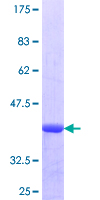 IL-33 Protein - 12.5% SDS-PAGE Stained with Coomassie Blue.
