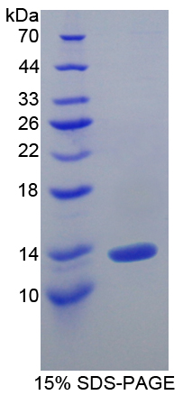 IL10RA Protein - Recombinant Interleukin 10 Receptor Alpha By SDS-PAGE