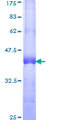 IL10RB Protein - 12.5% SDS-PAGE Stained with Coomassie Blue.