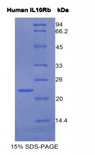 IL10RB Protein - Recombinant Interleukin 10 Receptor Beta By SDS-PAGE