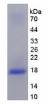 IL10RB Protein - Active Interleukin 10 Receptor Beta (IL10Rb) by SDS-PAGE