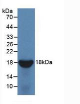 IL10RB Protein - Active Interleukin 10 Receptor Beta (IL10Rb) by WB
