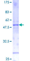 IL11 Protein - 12.5% SDS-PAGE of human IL11 stained with Coomassie Blue