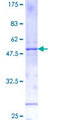 IL11 Protein - 12.5% SDS-PAGE of human IL11 stained with Coomassie Blue