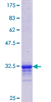 IL11 Protein - 12.5% SDS-PAGE Stained with Coomassie Blue.