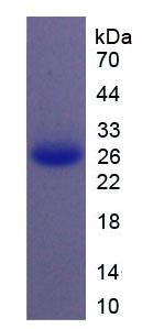 IL11 Protein - Active Interleukin 11 (IL11) by SDS-PAGE