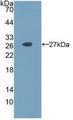IL11 Protein - Active Interleukin 11 (IL11) by WB