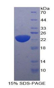 IL11 Protein - Recombinant Interleukin 11 By SDS-PAGE