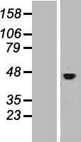 IL11RA Protein - Western validation with an anti-DDK antibody * L: Control HEK293 lysate R: Over-expression lysate