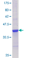 IL12A / p35 Protein - 12.5% SDS-PAGE Stained with Coomassie Blue.