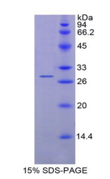 IL12A / p35 Protein - Recombinant Interleukin 12A By SDS-PAGE