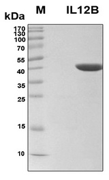 IL12B / IL12 p40 Protein